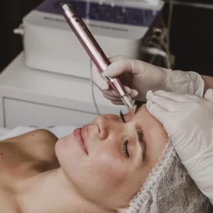 Image Microneedling