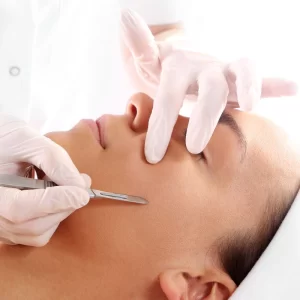 Image of Dermaplaning