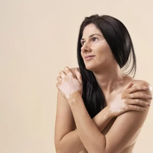 Image of Skin Rejuvenation - Arms and RF Arm Contouring