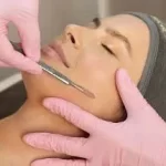 What Is Dermaplaning?