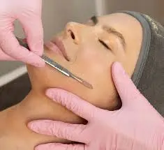 What Is Dermaplaning?