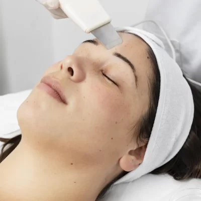 Image of Acne Treatments - Face