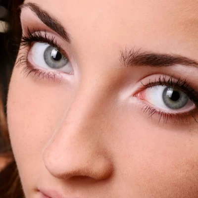 Bright Eyes Image of Bright Eyes
