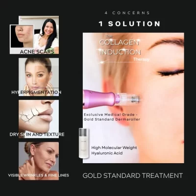 Medical-Grade-Microneedling-_-AnteAGE®-High-Molecular-Weight-Hyaluronic-Acid-in-Victoria-BC-Best-microneedling-promo-sale